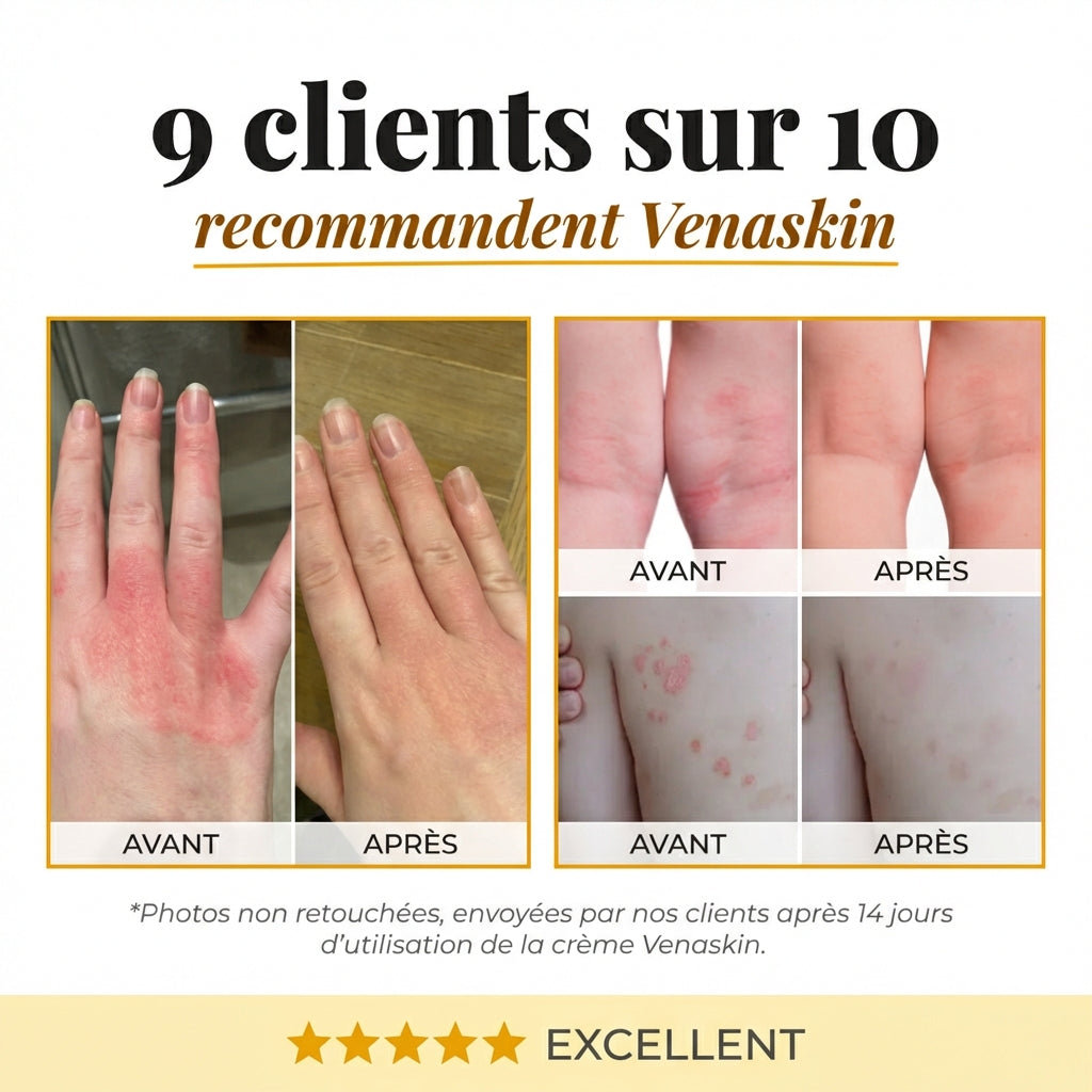 Crème Venin d'Abeille